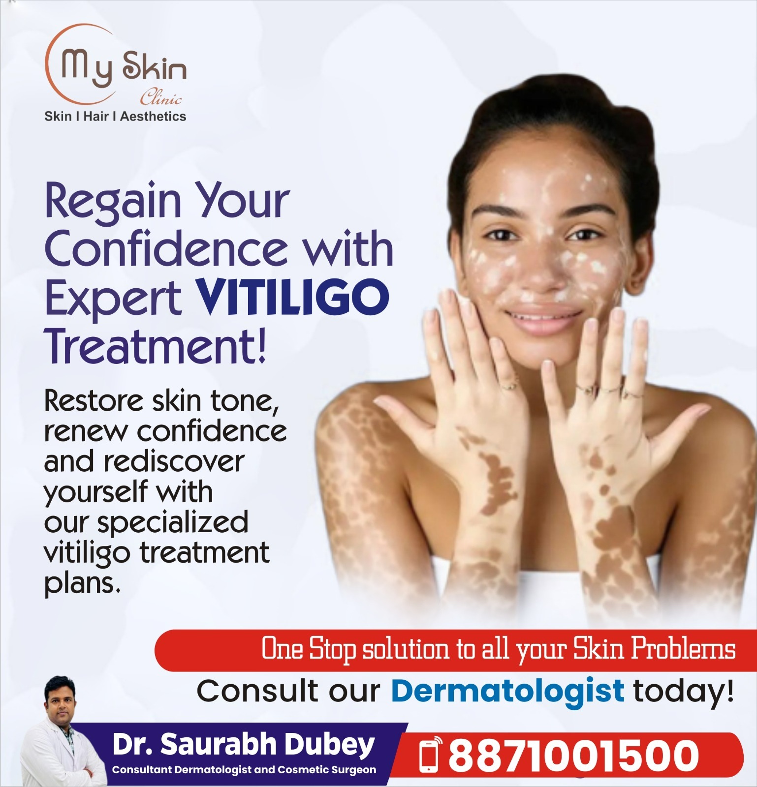 Expert Vitiligo Treatment in Indore